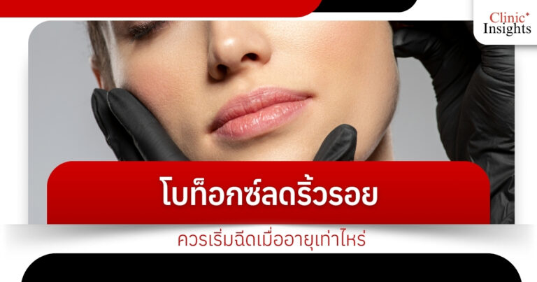 โบท็อกซ์ลดริ้วรอย ควรเริ่มฉีดเมื่ออายุเท่าไหร่