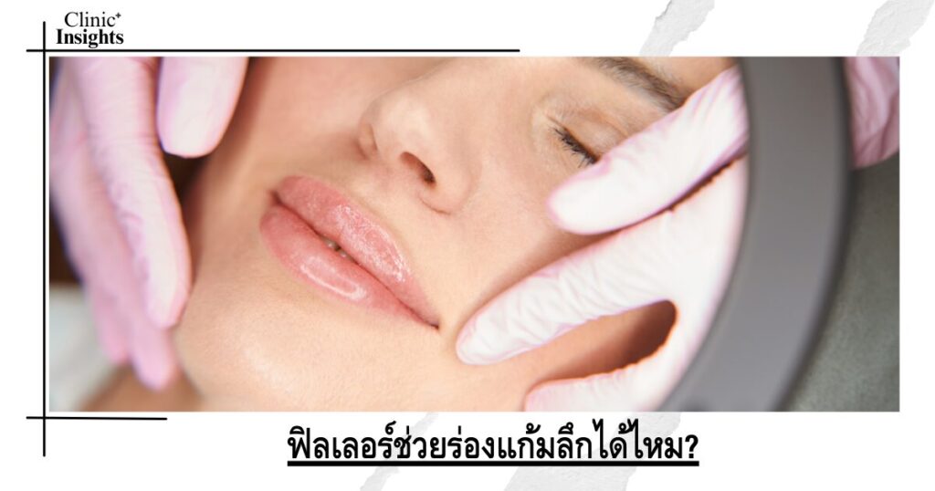ฟิลเลอร์ช่วยร่องแก้มลึกได้ไหม