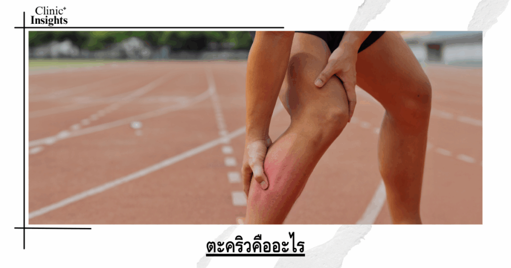 What is a cramp?