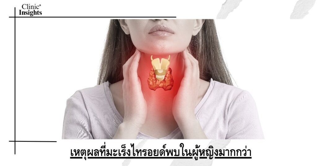 เหตุผลที่มะเร็งไทรอยด์พบในผู้หญิงมากกว่า