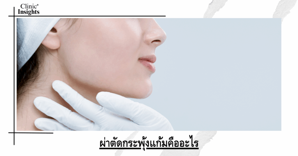 What is buccal surgery?