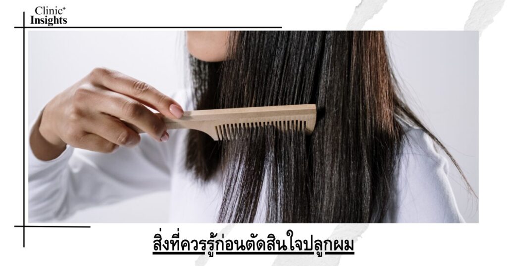 สิ่งที่ควรรู้ก่อนตัดสินใจปลูกผม
