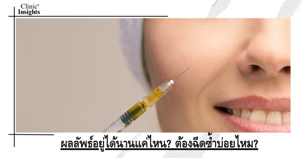 ผลลัพธ์อยู่ได้นานแค่ไหน_ ต้องฉีดซ้ำบ่อยไหม