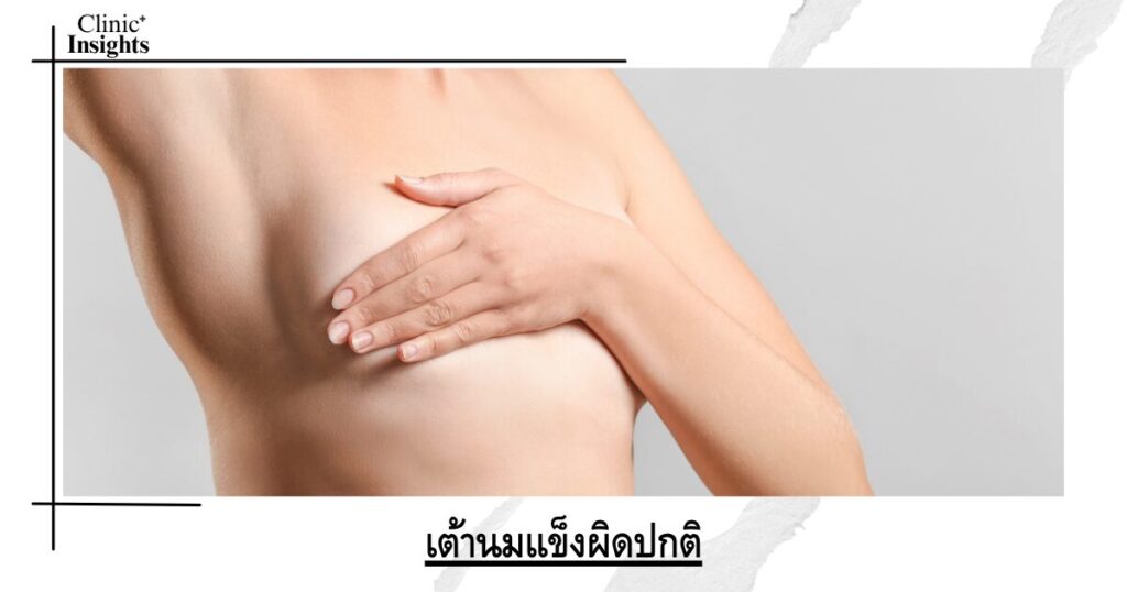 เต้านมแข็งผิดปกติ