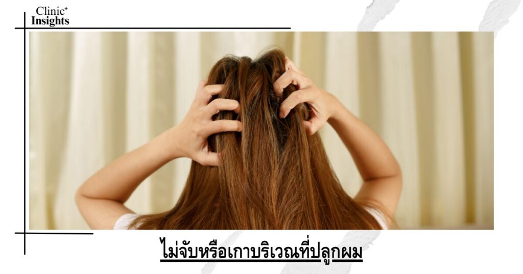ไม่จับหรือเกาบริเวณที่ปลูกผม