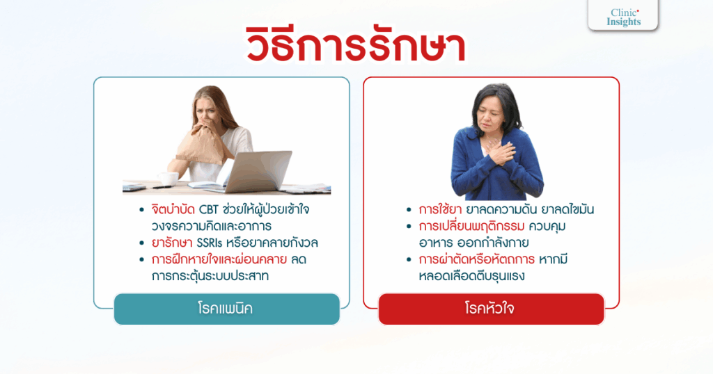 วิธีการรักษา
