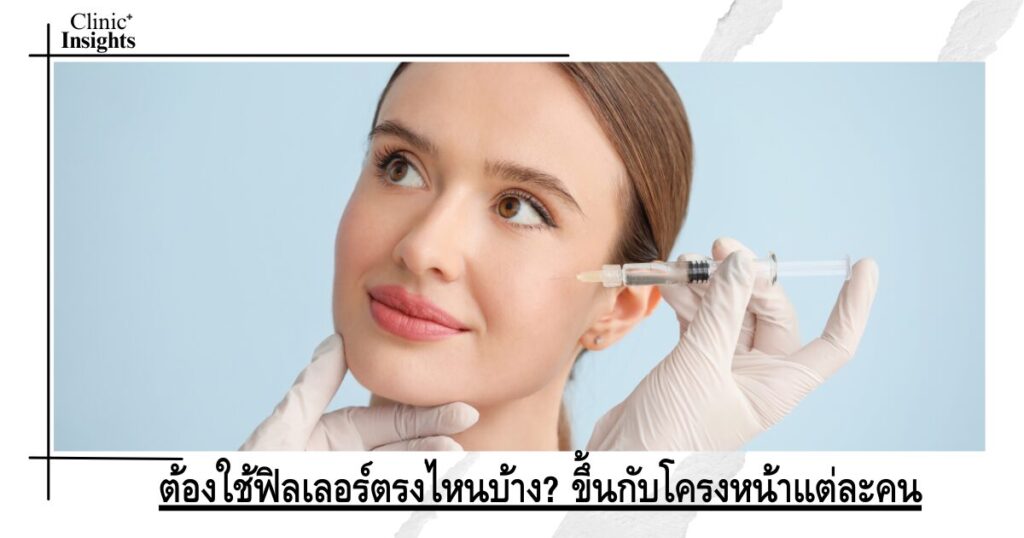 ต้องใช้ฟิลเลอร์ตรงไหนบ้าง_ ขึ้นกับโครงหน้าแต่ละคน
