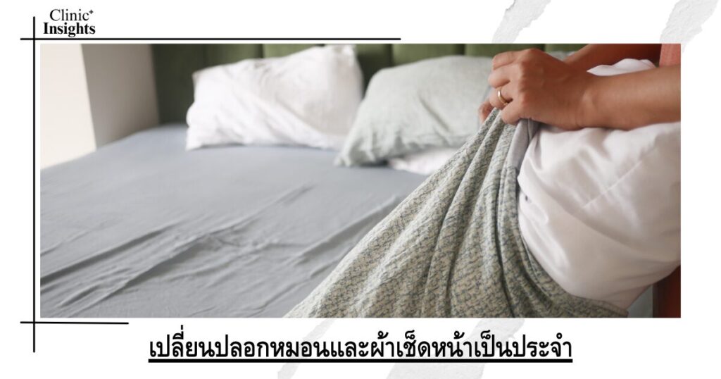 เปลี่ยนปลอกหมอนและผ้าเช็ดหน้าเป็นประจำ
