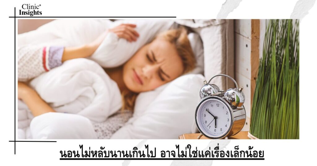 นอนไม่หลับนานเกินไป อาจไม่ใช่แค่เรื่องเล็กน้อย