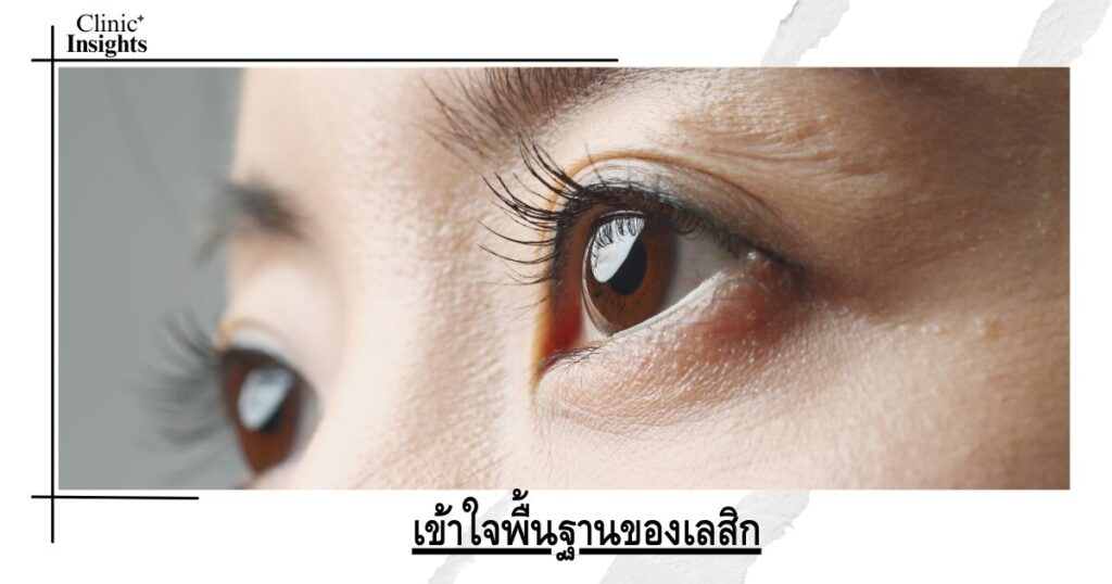 เข้าใจพื้นฐานของเลสิก