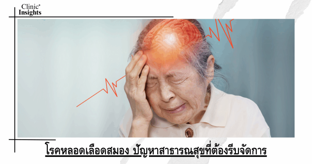 Stroke: A public health problem that needs urgent management
