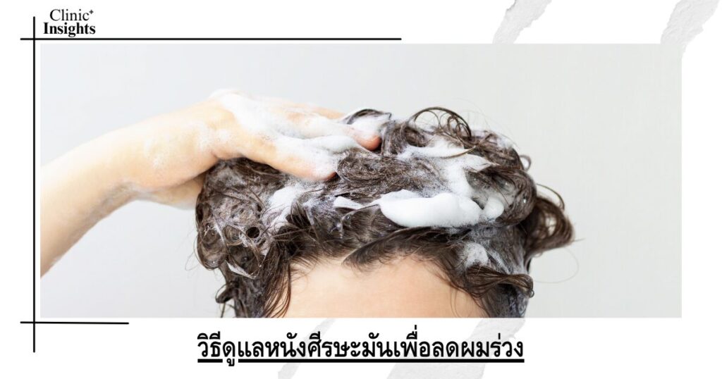 วิธีดูแลหนังศีรษะมันเพื่อลดผมร่วง
