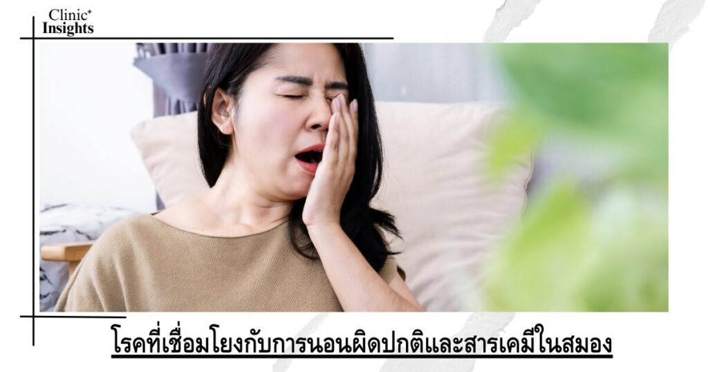 โรคที่เชื่อมโยงกับการนอนผิดปกติและสารเคมีในสมอง