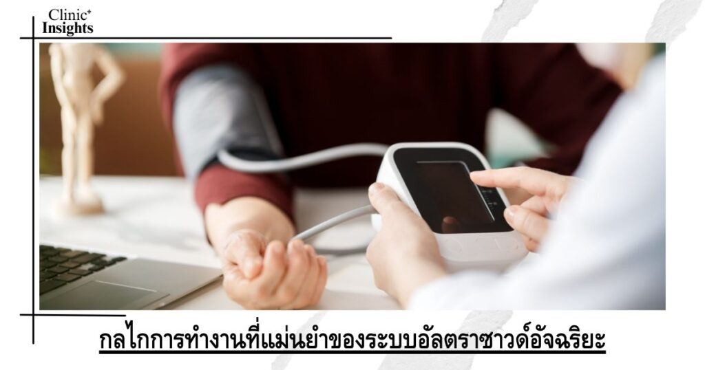 กลไกการทำงานที่แม่นยำของระบบอัลตราซาวด์อัจฉริยะ