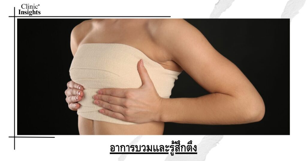 อาการบวมและรู้สึกตึง