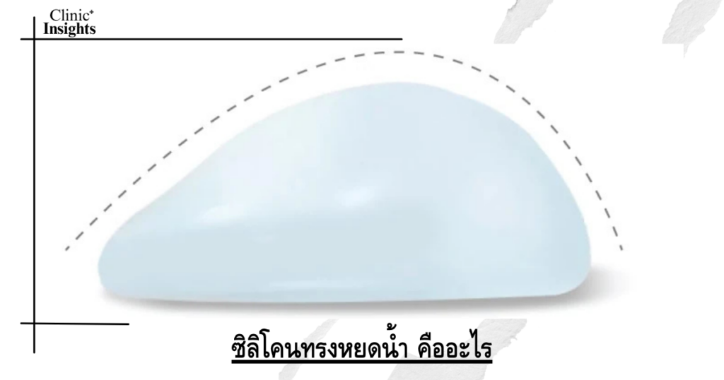 ซิลิโคนทรงหยดน้ำ คืออะไร