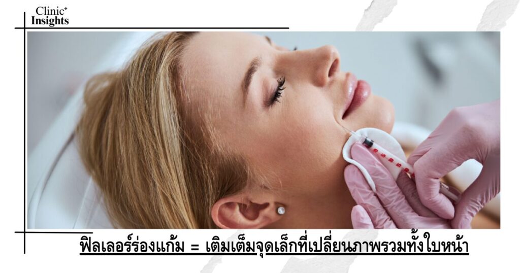ฟิลเลอร์ร่องแก้ม = เติมเต็มจุดเล็กที่เปลี่ยนภาพรวมทั้งใบหน้า