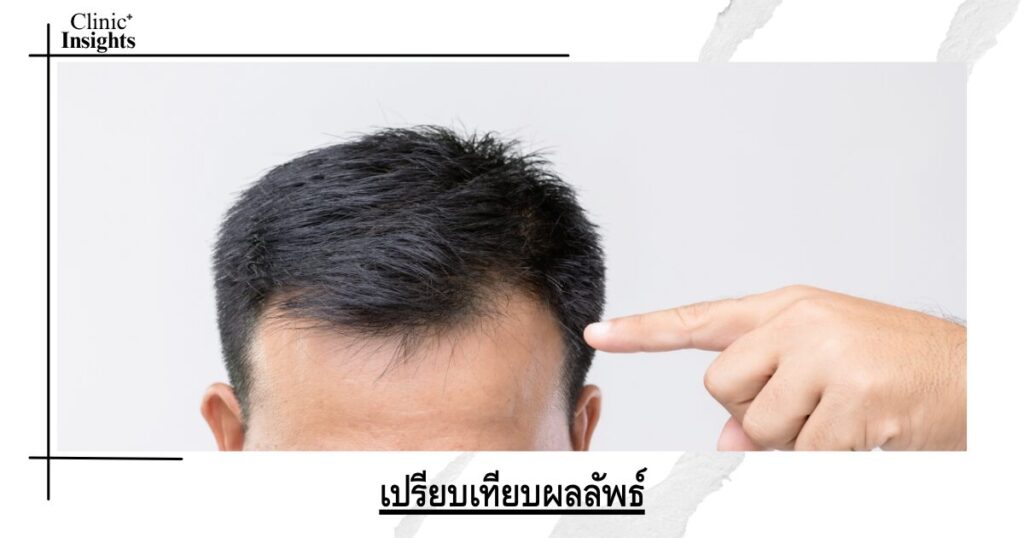 เปรียบเทียบผลลัพธ์
