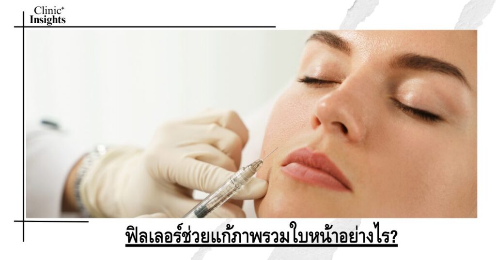 ฟิลเลอร์ช่วยแก้ภาพรวมใบหน้าอย่างไร