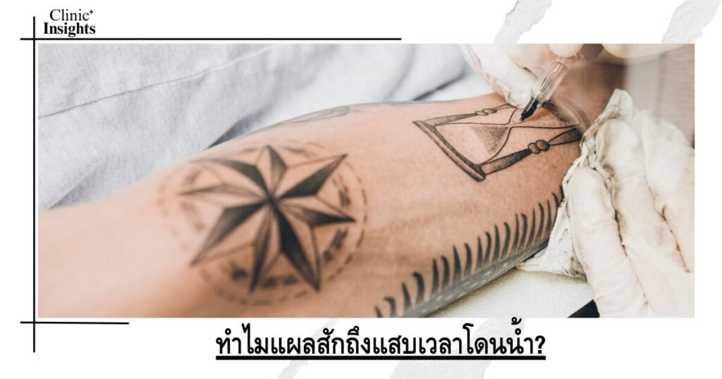 ทำไมแผลสักถึงแสบเวลาโดนน้ำ