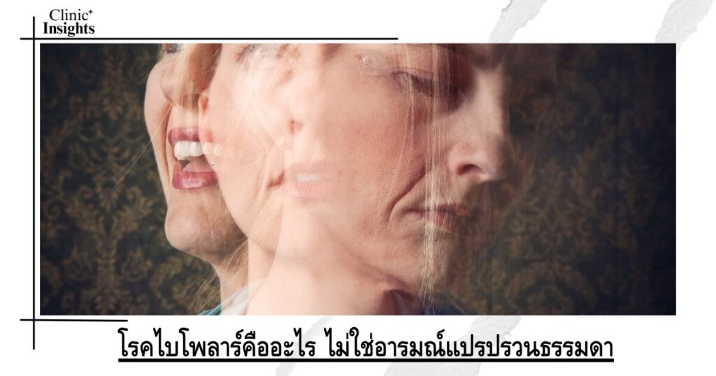 โรคไบโพลาร์คืออะไร ไม่ใช่อารมณ์แปรปรวนธรรมดา โรคไบโพลาร์คืออะไร ไม่ใช่อารมณ์แปรปรวนธรรมดา