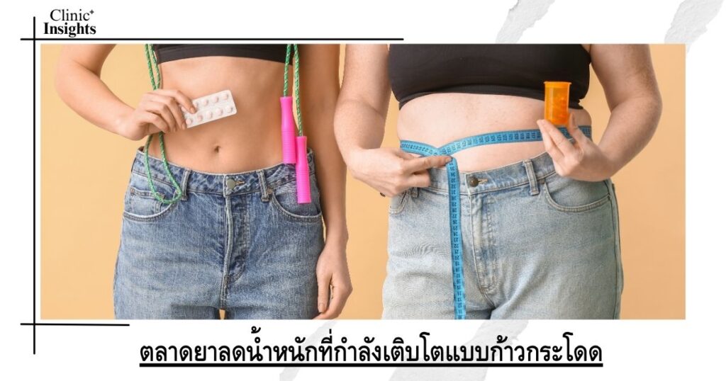 ตลาดยาลดน้ำหนักที่กำลังเติบโตแบบก้าวกระโดด
