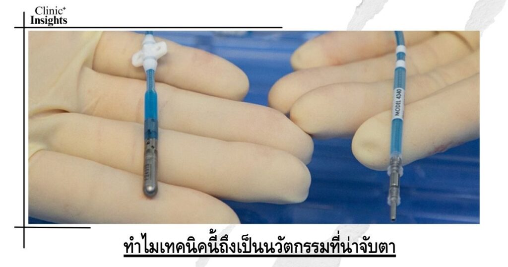 ทำไมเทคนิคนี้ถึงเป็นนวัตกรรมที่น่าจับตา