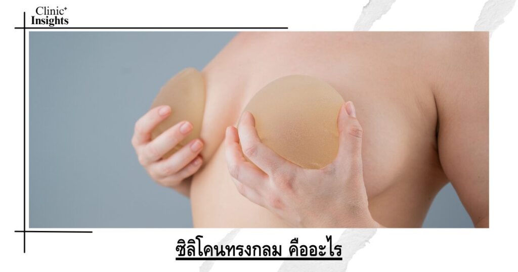 ซิลิโคนทรงกลม คืออะไร
