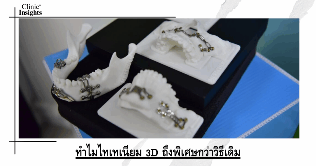 Why is 3D Titanium more special than traditional methods?