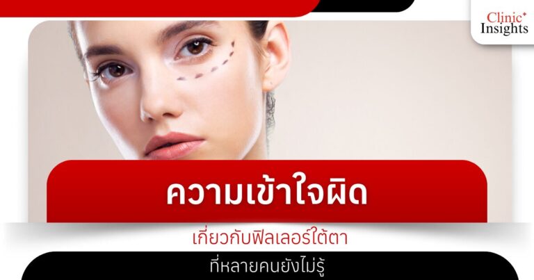 ความเข้าใจผิดเกี่ยวกับฟิลเลอร์ใต้ตาที่หลายคนยังไม่รู้