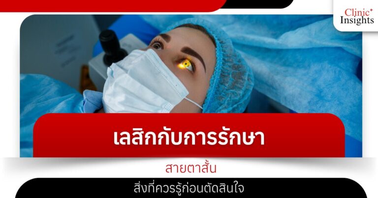 เลสิกกับการรักษาสายตาสั้น สิ่งที่ควรรู้ก่อนตัดสินใจ
