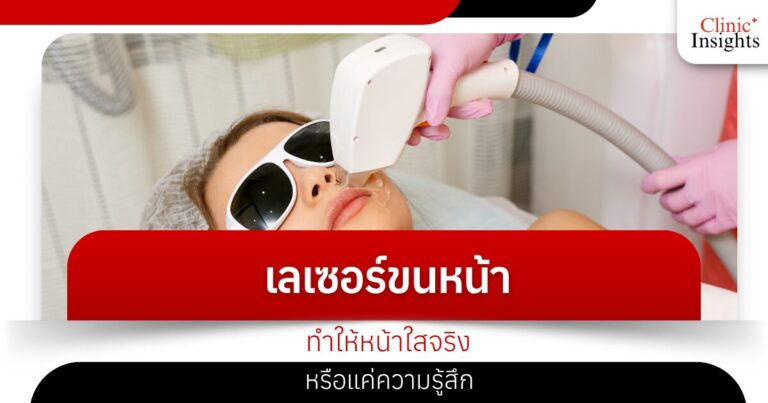 เลเซอร์ขนหน้าทำให้หน้าใสจริงหรือแค่ความรู้สึก
