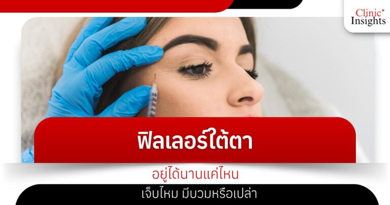 ฟิลเลอร์ใต้ตาอยู่ได้นานแค่ไหน เจ็บไหม มีบวมหรือเปล่า