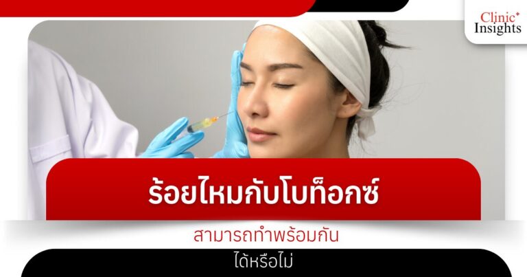 ร้อยไหมกับโบท็อกซ์ สามารถทำพร้อมกันได้หรือไม่