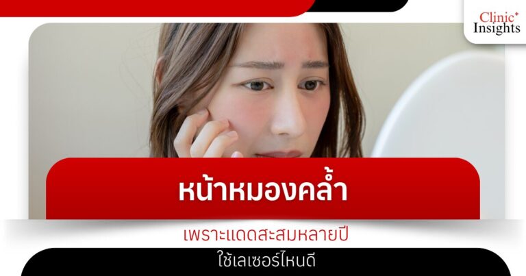 หน้าหมองคล้ำเพราะแดดสะสมหลายปีใช้เลเซอร์ไหนดี