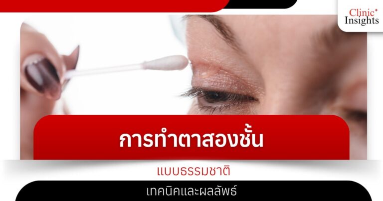 การทำตาสองชั้นแบบธรรมชาติ เทคนิคและผลลัพธ์