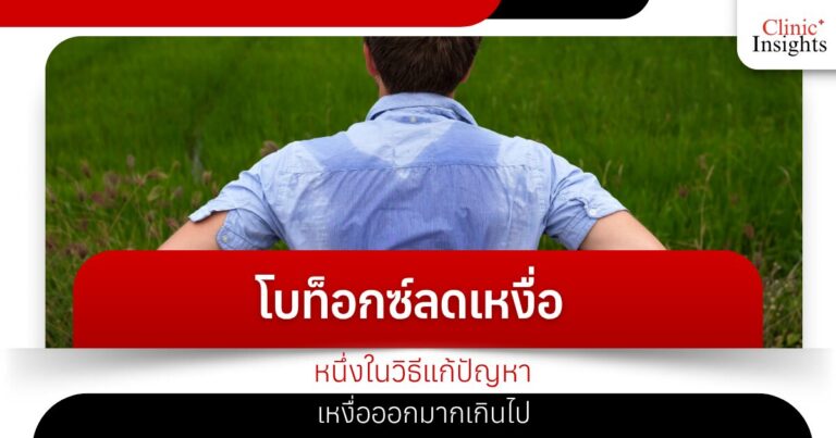 โบท็อกซ์ลดเหงื่อ หนึ่งในวิธีแก้ปัญหาเหงื่อออกมากเกินไป