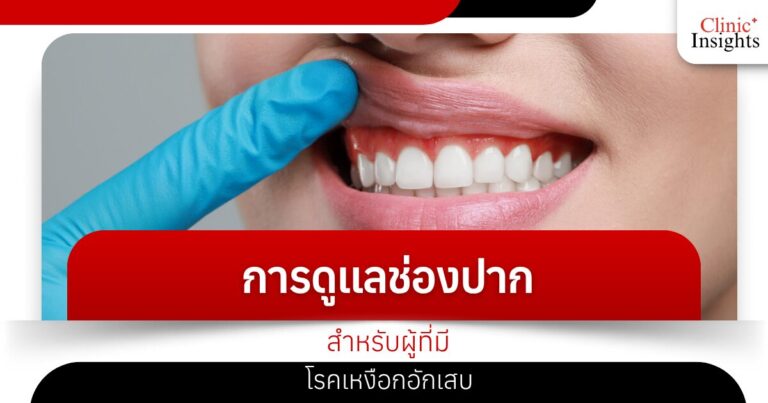 การดูแลช่องปากสำหรับผู้ที่มีโรคเหงือกอักเสบ​