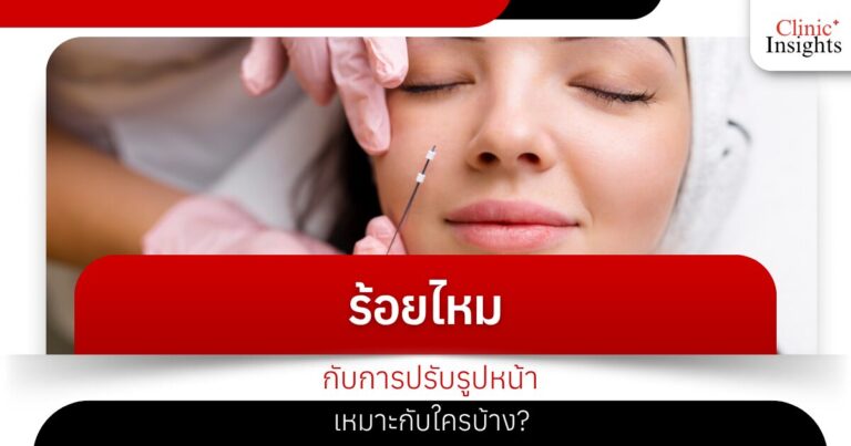 ร้อยไหมกับการปรับรูปหน้า เหมาะกับใครบ้าง