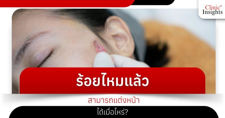 ร้อยไหมแล้วสามารถแต่งหน้าได้เมื่อไหร่