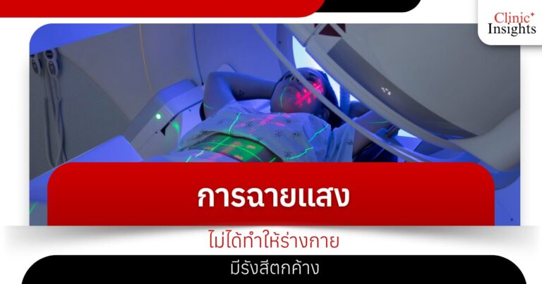 การฉายแสงไม่ได้ทำให้ร่างกายมีรังสีตกค้าง