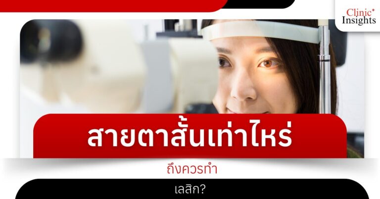 สายตาสั้นเท่าไหร่ ถึงควรทำเลสิก_​