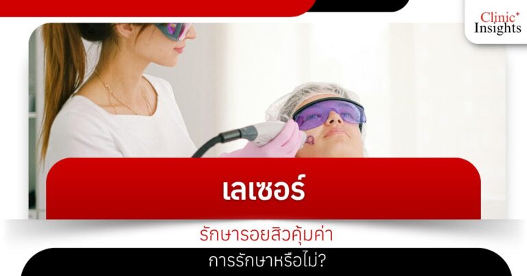 เลเซอร์รักษารอยสิวคุ้มค่าการรักษาหรือไม่_​
