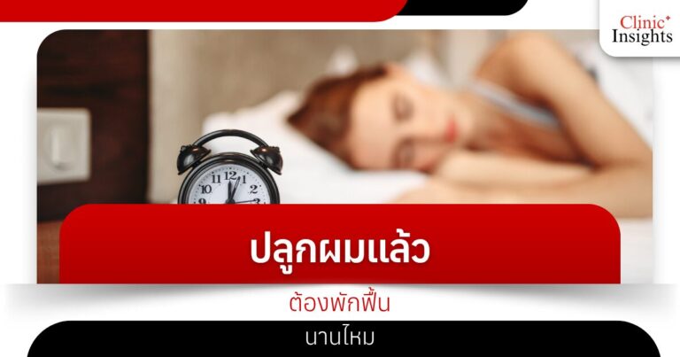 ปลูกผมแล้วต้องพักฟื้นนานไหม