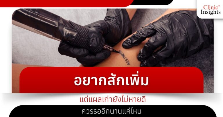 อยากสักเพิ่มแต่แผลเก่ายังไม่หายดีควรรออีกนานแค่ไหน