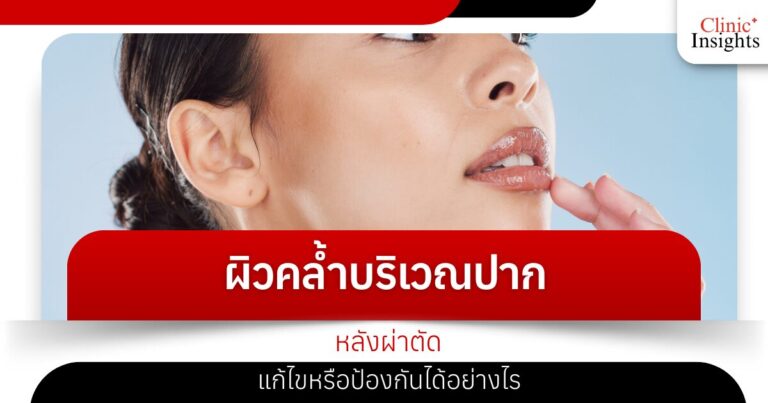 ผิวคล้ำบริเวณปากหลังผ่าตัด แก้ไขหรือป้องกันได้อย่างไร