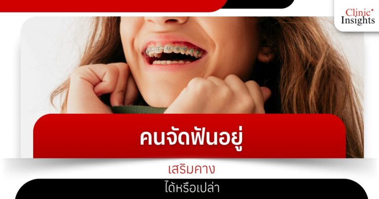 คนจัดฟันอยู่เสริมคางได้หรือเปล่า