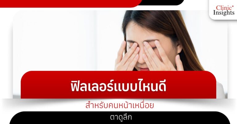 ฟิลเลอร์แบบไหนดีสำหรับคนหน้าเหนื่อย ตาดูลึก