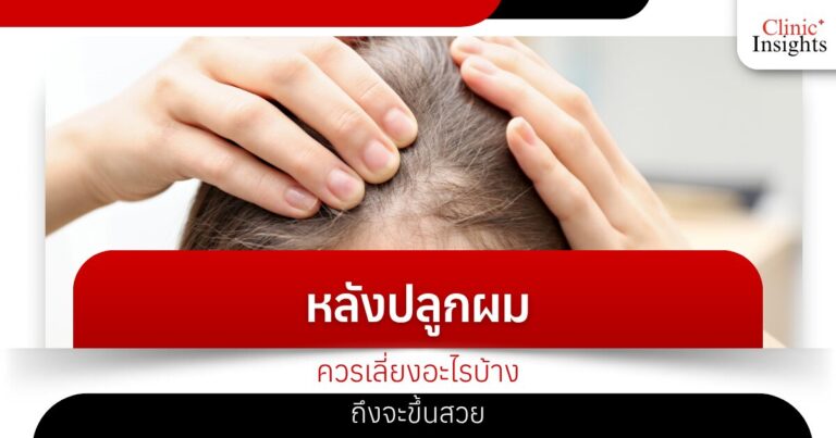 หลังปลูกผมควรเลี่ยงอะไรบ้างถึงจะขึ้นสวย