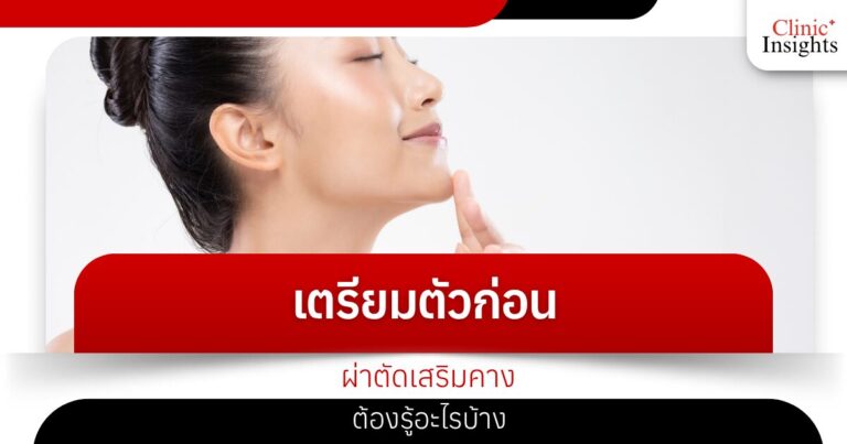 เตรียมตัวก่อนผ่าตัดเสริมคาง ต้องรู้อะไรบ้าง